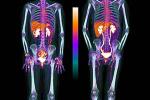 Scan of entire body with lit images indicating inflammation
