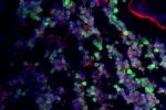 A highly magnified image of cells in the gut.