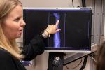 Woman pointing at x-ray of wrist and hand