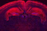 Widespread of transfected cells in the brain by in utero delivery Cre mRNA 