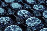 Series of x-ray images of brain scans
