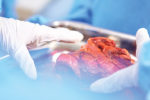 Hands with blue medical gloves near human liver organ resting on table.