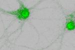 Two images show neurons in green against a grey background with a concentration of brighter green the center of the neuron.