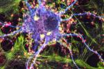 Colored image of nerve cells. 