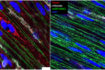 Piezo1 mechanosensor in smooth muscle cell