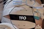 Device is shown on top of pregnant belly