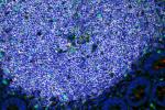 A highly magnified image of gut-associated lymphoid tissue.