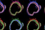 Composite images of a cross-sectional aortae