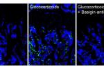 Images of Basigin in bone/bone marrow of mice treated with Placebo, Glucocorticoids or Glucocorticoids and Basigin Antibody.