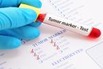 Blood sample with requisition form for tumor marker test