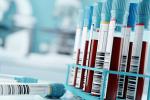 Test tubes filled with blood in a lab.