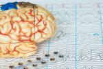 brain on a electrocardiogram with electrodes beside 