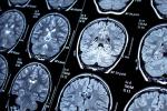 Brain images