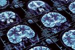 Brain scans