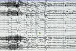 A computer screen shows a white background with EEG waveform readouts and continuous video of a patient.