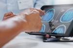 A health care provider points to an image of a brain scan on a computer tablet. 