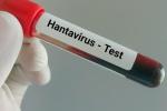 Blood sample for hantavirus test