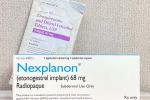 A pack of birth control pills and a Nexplanon implant