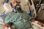 Kyle Benton was hospitalized for 43 days.