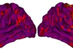 Two MRI scans of human brains highlighted in purple, red and yellow show different widths of the cortex.