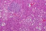 Purple and pink liver tissue.