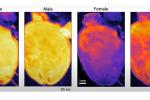 Four images of mouse hearts. Two show female and male hearts uniformly yellow, and two show a female heart with purple coloring at the bottom