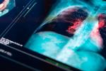 MRI lung scan