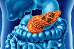 Human Pancreatic Cancer