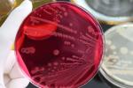 A gloved hand holds a petri with red agar showing growth of bacteria. 
