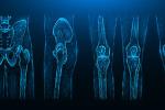 Xray of four sections of human skeleton