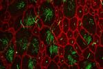 Primary cilia