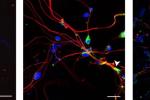chromosome activation