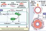 Schematic chart of arteries in the lungs