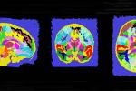 A series of brain scans with each section of the brain highlighted a different color.