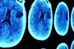 a series of CT scans of skulls, hanging on a wall and lit up a blue color