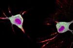 Two neurons with light green central bodies with bright magenta spots are shown against a dark background. 