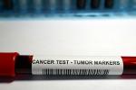 test tube marked cancer test - tumor markers
