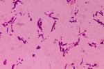 A microscopic view of gram stained slide showing Salmonella Typhi bacteria.