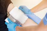 Nurse dressing a hand burn wound